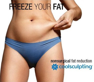 CoolSculpting