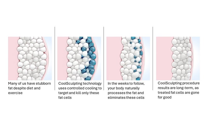 fat-cell-process