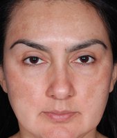 obagi-medical-treatment_1_after.jpg